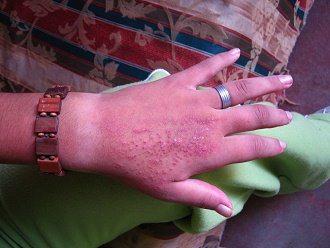 Eliah Pizarro Carbajal, die andere Hand