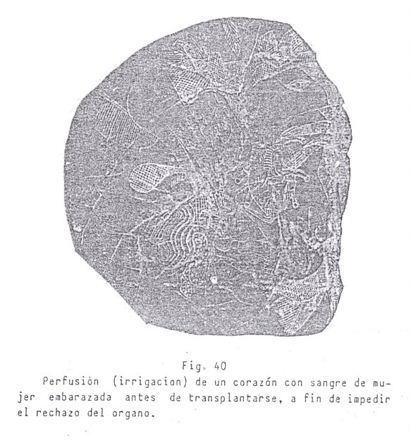 Fig. 40: Perfusi�n
                                de coraz�n