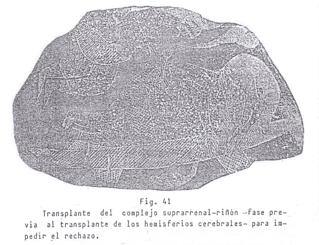 Translante de un
                                ri��n