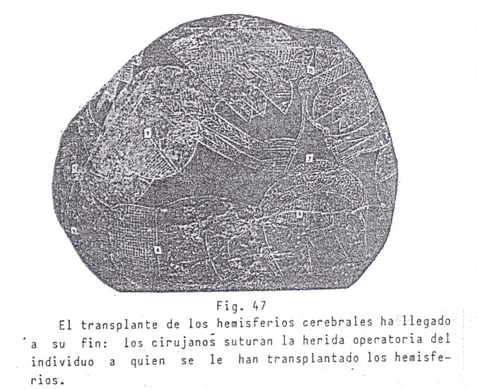 Fig.
                              47: Suturan la herida
