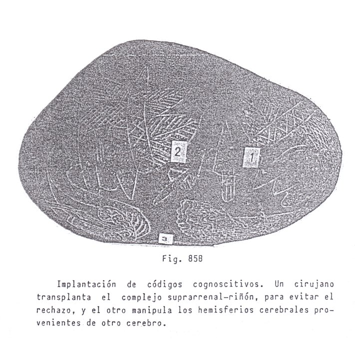 Fig.
                                85B: Implantaci�n de c�digos 02
