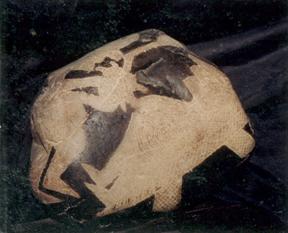 Herzoperation bei
                          einem Mann 03