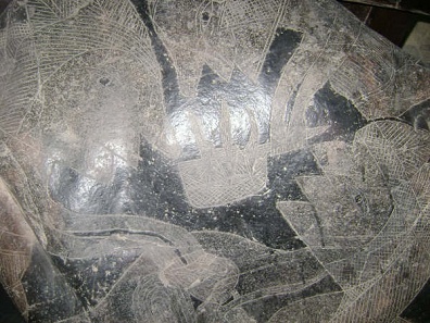 Leberoperation 03