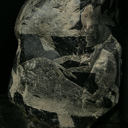 Bauchoperation 01