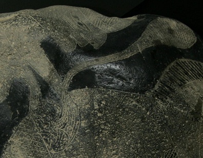 Kidney surgery,
                  close-up