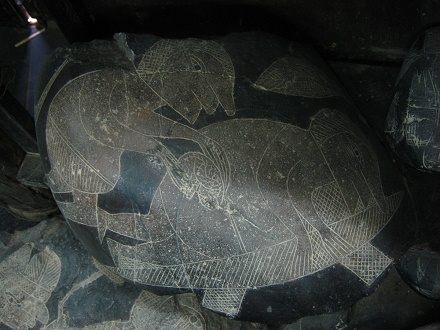 Nierenoperation 03