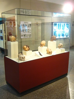 Vitrine mit aufgebohrten Sch�deln