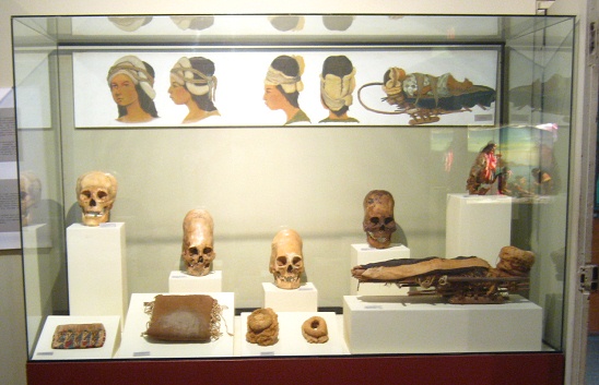 Vitrine mit deformierten Sch�deln
                          (Langsch�del) der Paracas-Kultur, Nahaufnahme